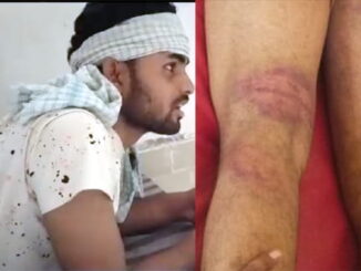 Khaki became merciless, 3 policemen lined up in the brutal beating of the young man