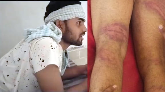 Khaki became merciless, 3 policemen lined up in the brutal beating of the young man