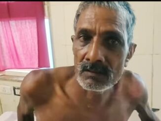 Pouring kerosene on an old man sleeping at home and burnt him to death during treatment