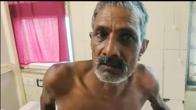 Pouring kerosene on an old man sleeping at home and burnt him to death during treatment